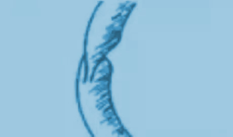 挖掘機(jī)密封件“扭轉(zhuǎn)”故障現(xiàn)象圖